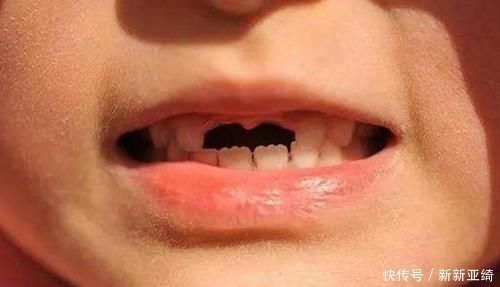 孩子“乳牙”脱落别着急扔,关键时刻能救命不懂为啥尽快了解下