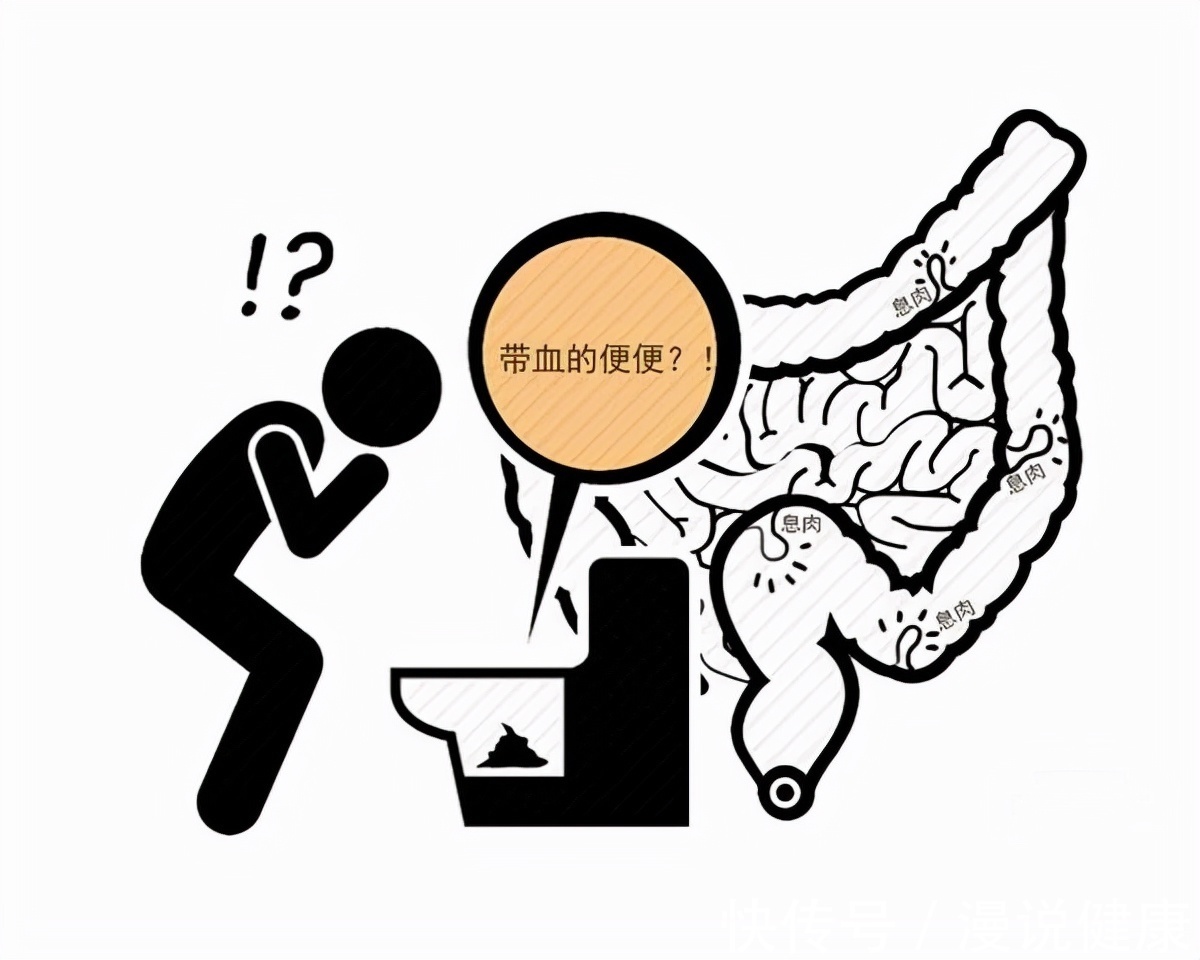 患者|便便是健康的放大镜？若出现这3种异常，许是大病发出的“警告”