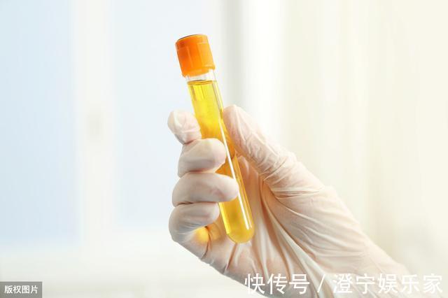 尿毒症|尿酸高了5种食物快忌口,谨防尿毒症上身