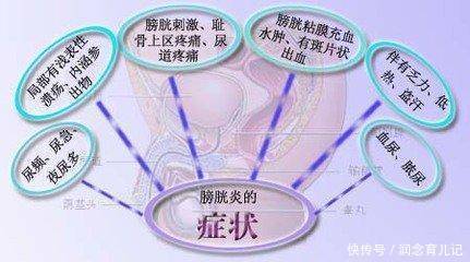 腺性膀胱炎怎么办 找对方法是关键 快资讯