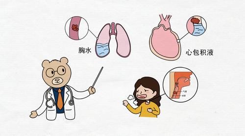 肺癌是如何转移的？