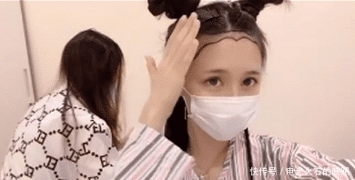 蔡萝莉发际线上移，为了美丽植发11个小时，一个毛囊报价12元