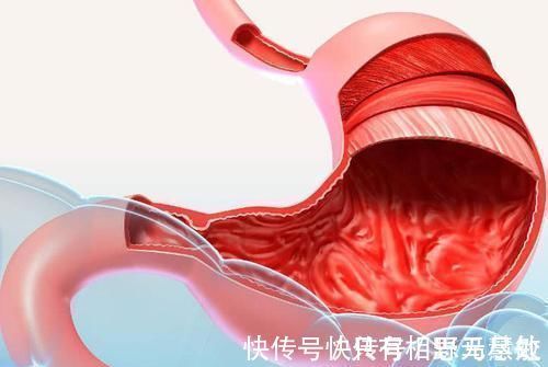 胃黏膜|胃病的“天敌”找到了, 每天坚持吃, 修复胃粘膜, 远离老胃病