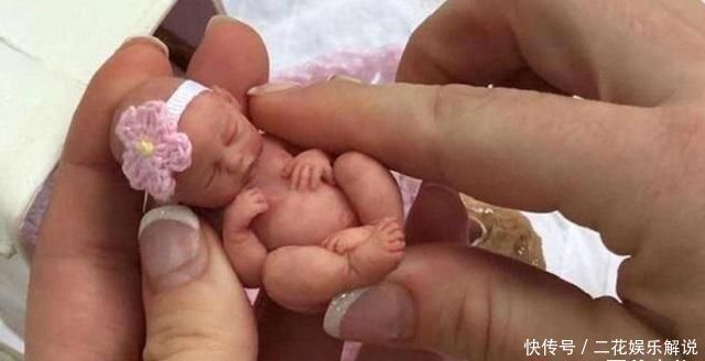 孕晚期|世界最小的婴儿已经14岁了,如今的现状,生活得有滋有味