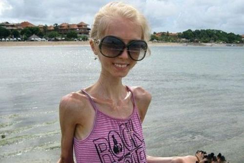 白斑|癌症形成期基本在36~45岁,若你没有这些现象,说明身体还算健康