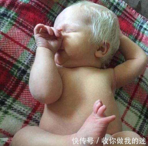 夫妻两人|婴儿生下就满头白发,父母差点将其丢弃,检查结果出人意外