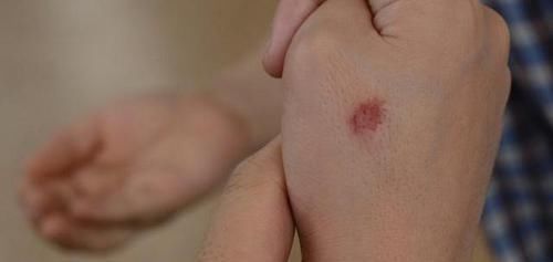 洋葱|胰岛素的“仓库”终于被发现了，经常换着吃，血糖慢慢降下来