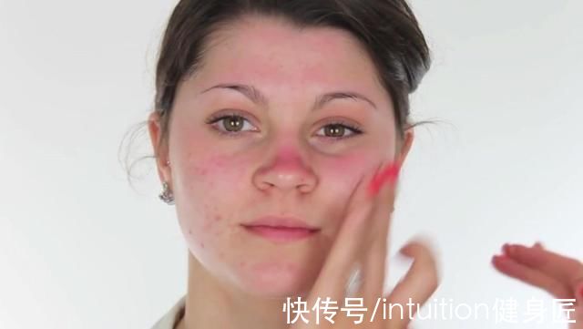 生活质量|血脂过高,身体可能会出现3种情况,要留意