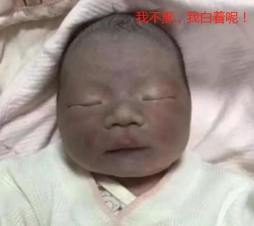 嫌弃|“黑脸宝宝”被亲妈嫌弃，护士却夸好看，2个月后高颜值逆袭