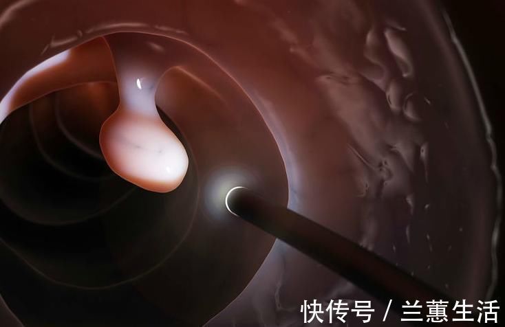 慢性胰腺炎|癌症一发现就是晚期，专家建议，身体的五种小病最好及时治疗