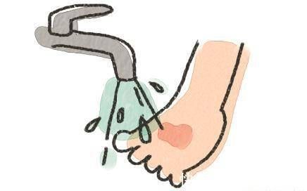 陈妈|孩子烫伤后,最佳治疗时间只有2分钟,你知道该怎么做吗?建议收藏