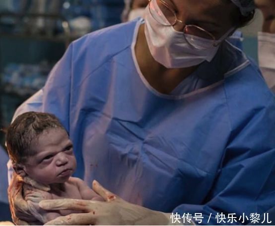 巴西“臭脸”宝宝走红,怒瞪医生引大笑,网友:表情包出炉