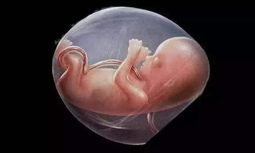 逆袭|90后宝妈生下“小包公”,全家人都嫌丑,两个月后逆袭成“团宠”