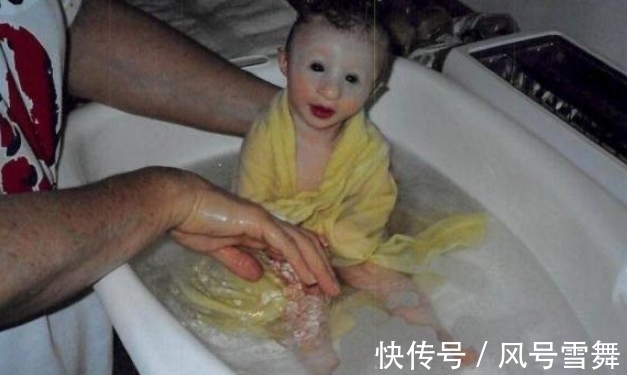 女童|她是世界上最小的女童，体重11公斤，一只烧鸡都比她大