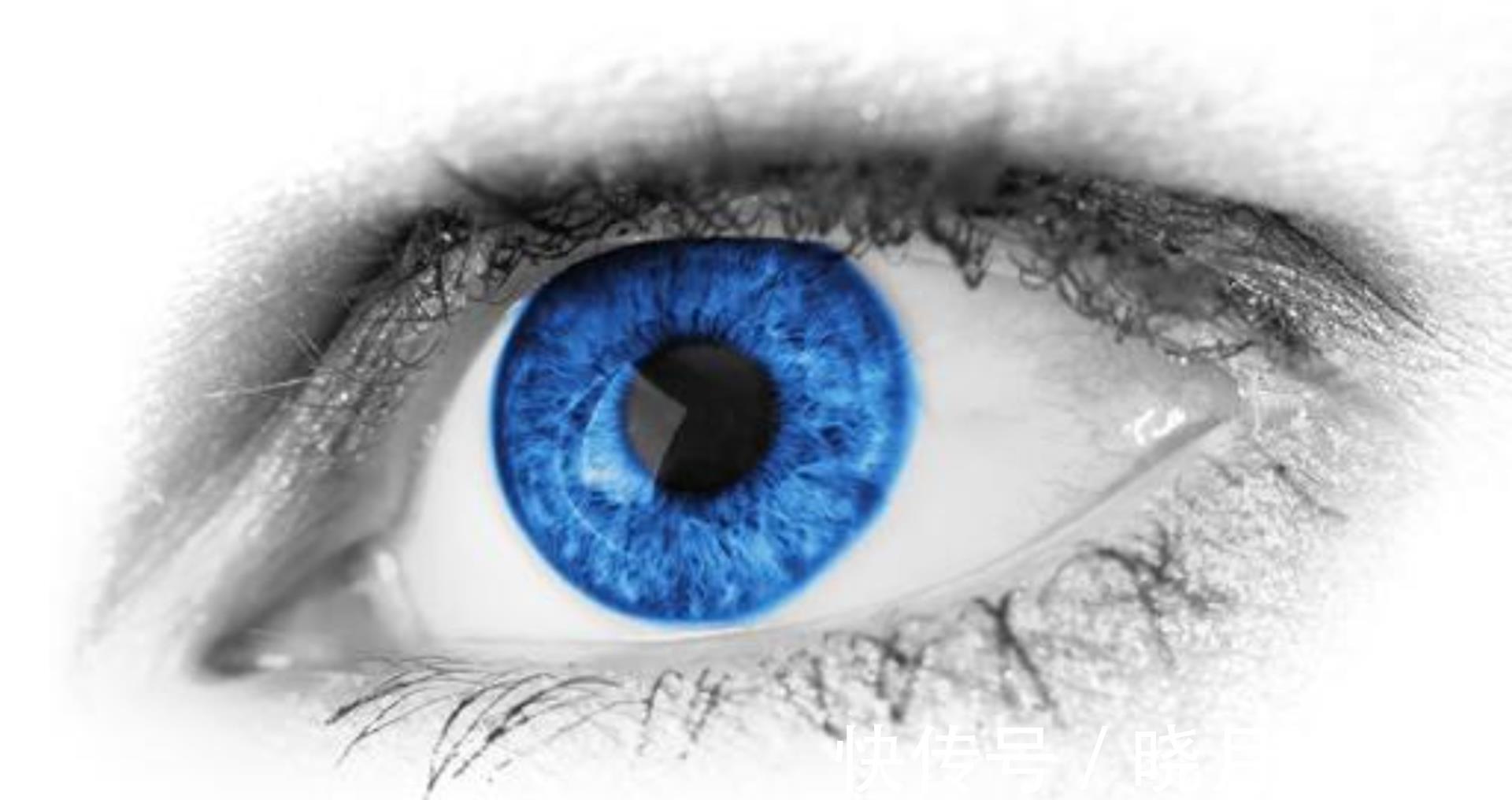 中度近视|微型镜片植入手术是什么?1000度近视恢复1.0视力,近视眼有救了