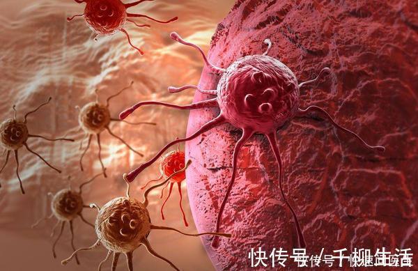 患者|肝癌复发转移？小心发生7种身体异常情况，引起足够的重视