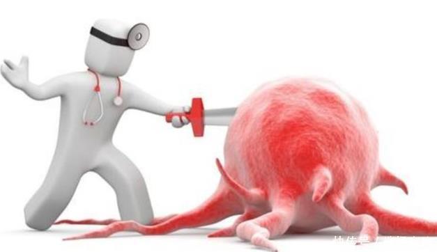 癌症早期|为什么癌症早期都不痛不痒、毫无症状看完受益终身