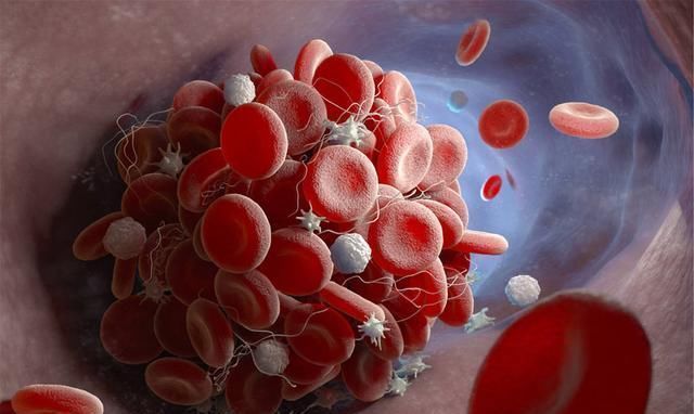 吸烟|血管的“去污剂”不是芹菜，平时紧着吃，给血管冲冲澡，血脂降了