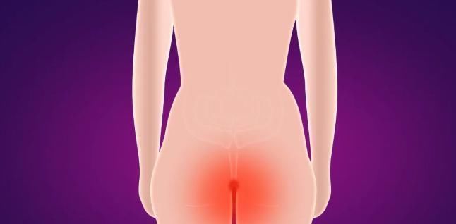 混合痔|痔疮难以根治，但有“死敌”！做好6件事，告别痛痒、肿大和出血