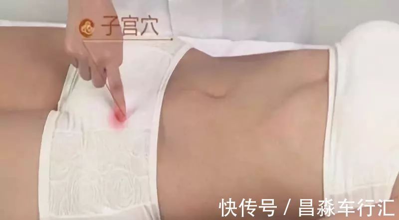 癌变|大家好!我叫“息肉”,癌症的近亲!我最怕无情又温柔的手术刀:艾灸