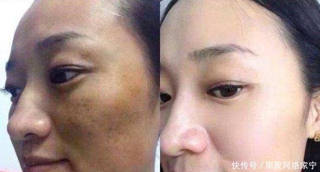 维生素E和它一起敷脸，使用7天美白祛斑，还能淡化细纹！