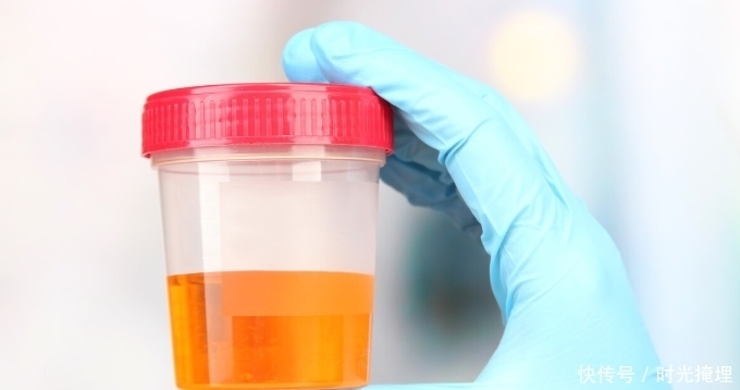 尿蛋白1十怎么调理?医生:现在明白也不迟