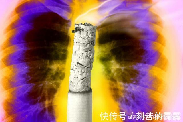 手术室|很多年前患的肺癌,现已奇迹治愈,这是怎么做到的