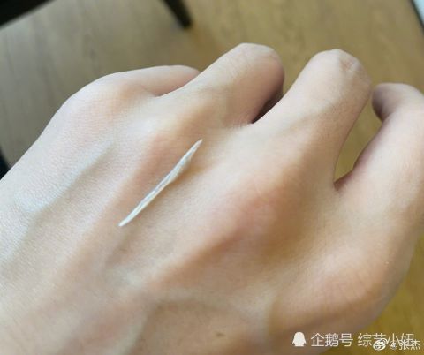 人生第一次|张杰被鱼骨卡食道,连夜胃镜麻醉摘除,自称吃鱼留下阴影