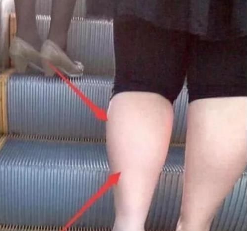 减肥|早上空腹“禁止”吃3物,相当于喝油,怪不得“大象腿”一直在