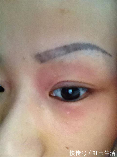 家长|4岁女儿误将胶水滴入眼睛,宝妈临危不乱的做法,医生直夸有文化