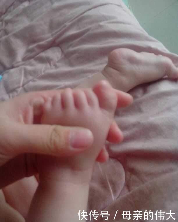 怀孕|一次产检没落却生下畸形儿!怀孕注意这些事,和产检一样重要!