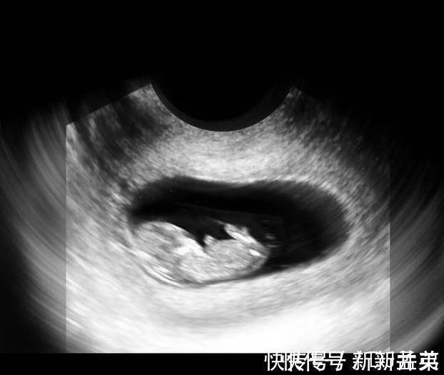 羊水|胎儿从卵泡到性别形成,17张图片清晰诠释,男宝女宝看得很清楚