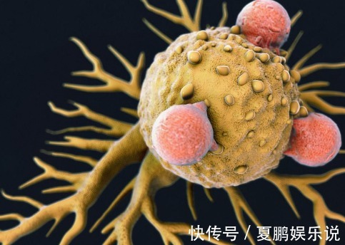 病人|肿瘤也被打败过,具有此条件的病人,肿瘤都可自行消退