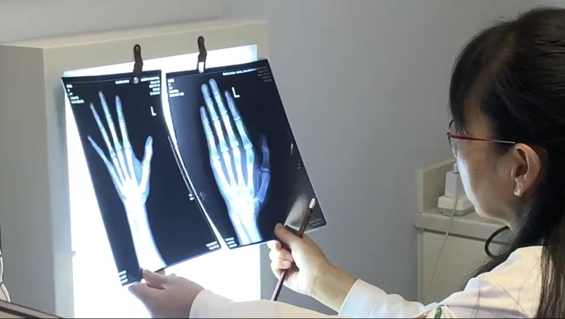 骨龄|天使讲堂:对于长高来说,骨龄为什么如此重要?