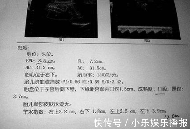 准妈妈|孕期,孕妈做四维彩超若有这些信号,怀男孩的可能性大吗