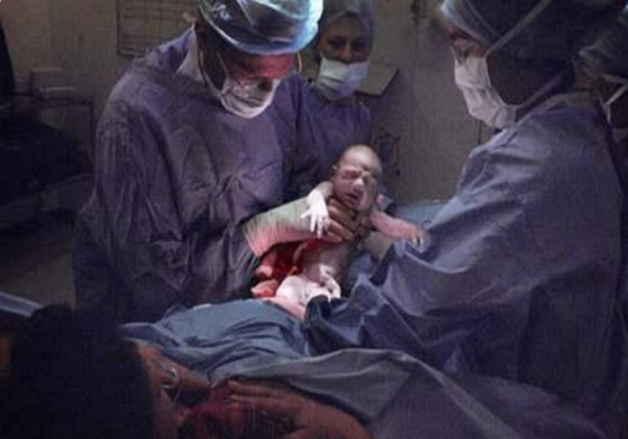 医护人员|顺产生娃是啥体验？过来人：宝宝被一把“拽出来”，再也不想生了