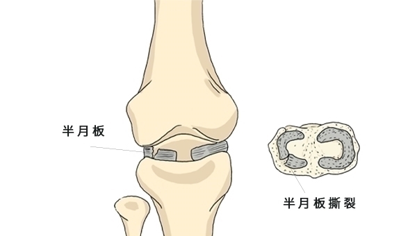 后辈|坚持每天晨跑,跑了31年,现已85岁,大爷的经历值得后辈学习