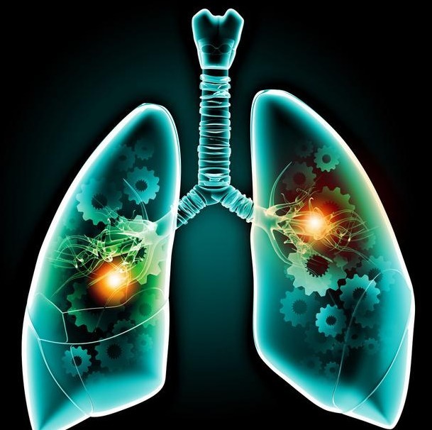 祛痰|慢性支气管炎,喉咙有痰,咳不出咽不下试试2个方法,轻松祛痰