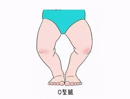 孩子|女婴多长一根手指,老人用土办法“治疗”,孩子差点要截肢