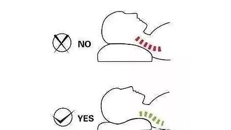 颈椎|枕头不适合也会导致颈椎病！教你如何挑选合适的枕头来保护颈椎！