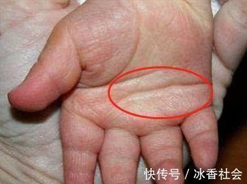 孩子|孩子将来是否聪明,看看小手就知道,智商高低在手上就有信号