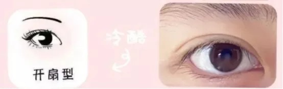 任晓霞:如何选择适合自己的双眼皮手术方式?丨科普篇