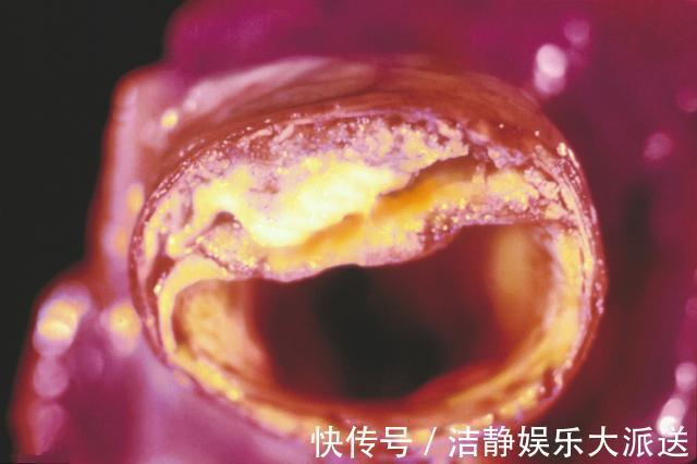 男人|“短命”的男人,身体3处总是“硬硬的”,希望你一个也没有!