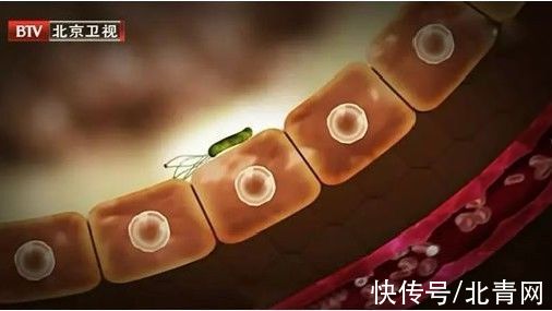 本草纲目|1/6的癌症都是炎症引起的！4类“促炎”饮食，让身体炎症越来越高发！别再吃错了