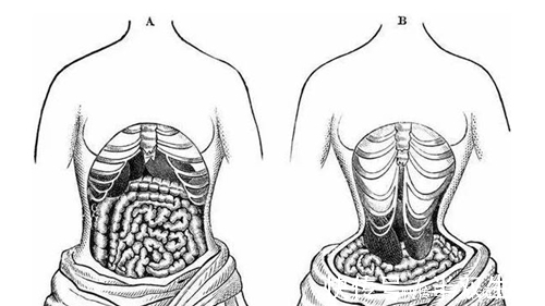 畸形#古代畸形审美,欧洲束腰中国缠足都已废除,唯日本将其传承了下来