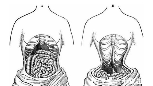 畸形#古代畸形审美，欧洲束腰中国缠足都已废除，唯日本将其传承了下来