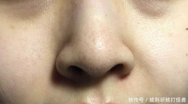 给面部补水的这4大“死角”,常常被忽略,别再傻傻不知道了