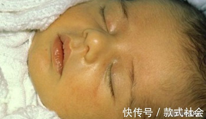宝宝|在孕期,这4件事孕妈要做好,能有效预防宝宝出生患黄疸,别大意