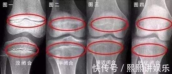 好处|宝妈生完孩子长高了5厘米,除了长身高,怀孕还有几个更大的好处