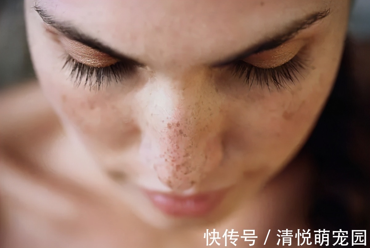 大便|便秘不要用手抠,医生直言:做到1件事,隔天拉得又快又多